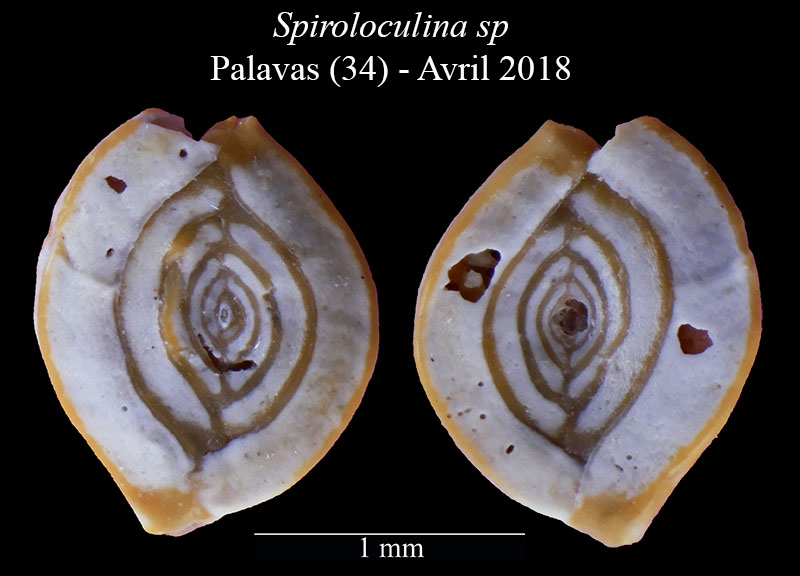 Spiroloculina sp. #56141