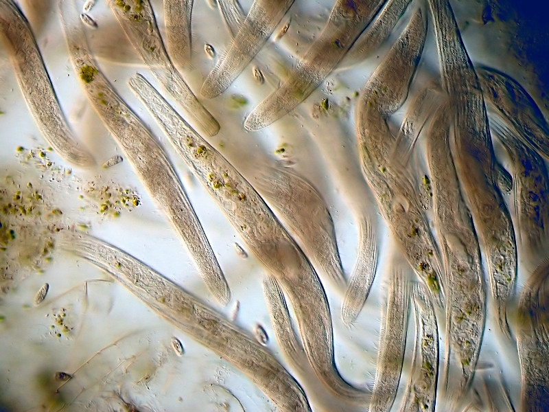 Spirostomum #25697