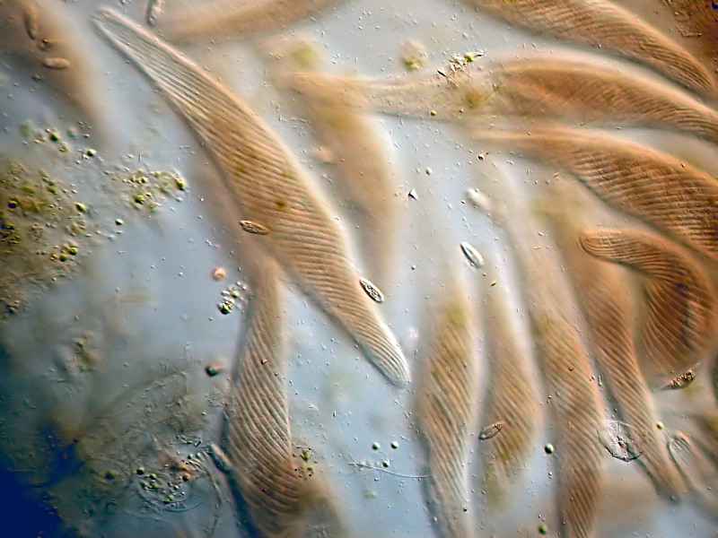 Spirostomum #25698