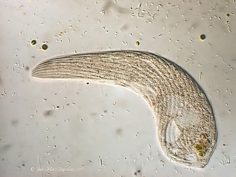 Spirostomum #25743