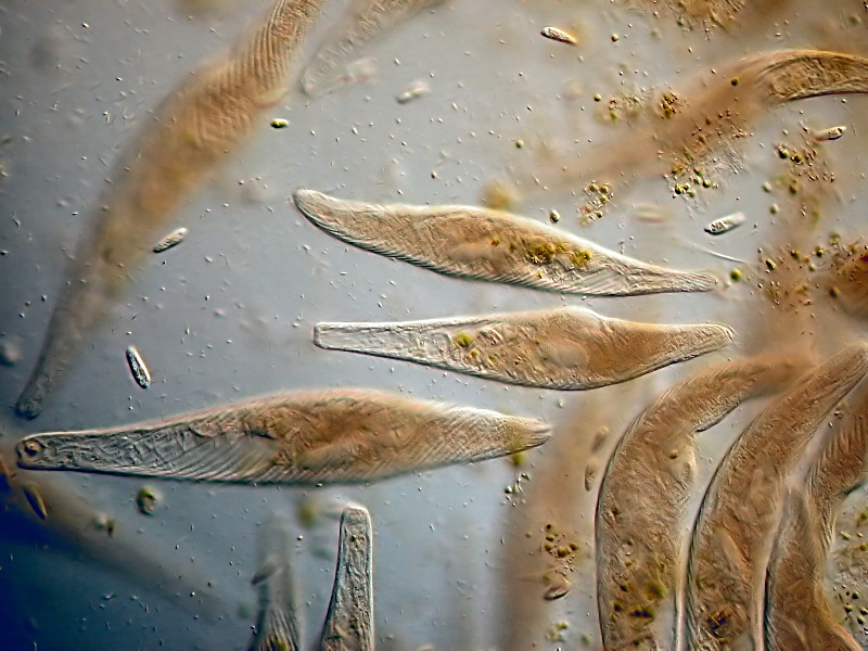 Spirostomum #25699