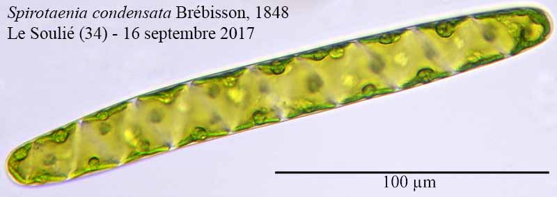 Spirotaenia condensata #51574