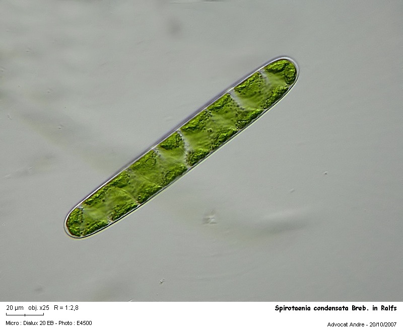 Spirotaenia condensata Breb.in Ralfs #395