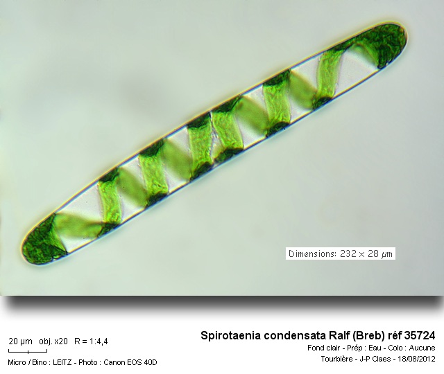 Spirotaenia condensata #27971