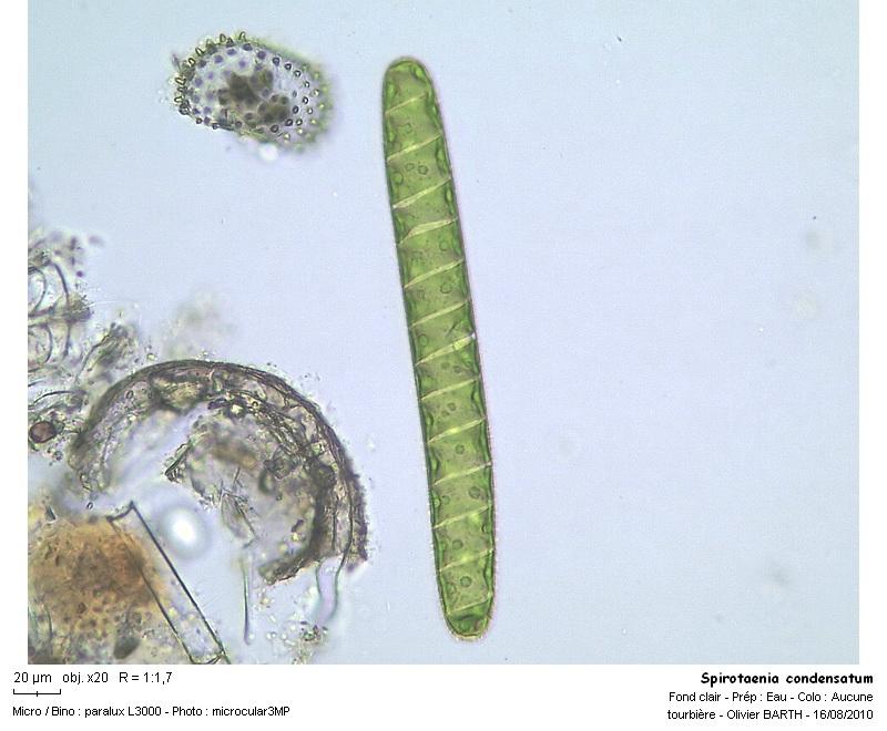 Spirotaenia condensata #17671