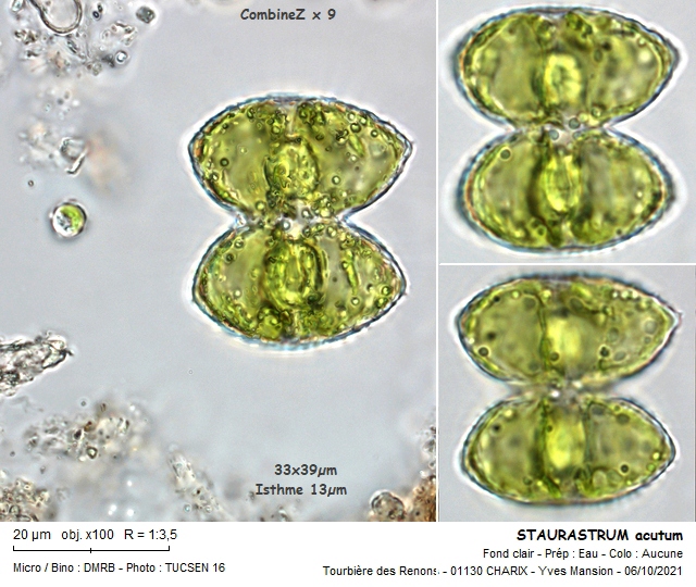 STAURASTRUM acutum #68265