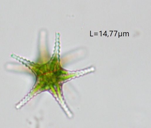 Staurastrum arachne Ralfs ex Ralfs, 1848 #72698