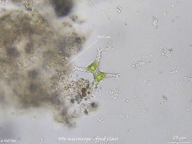 Staurastrum bloklandiae #76088