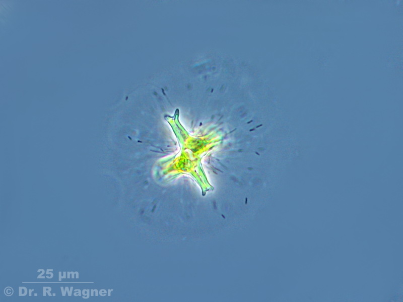 Staurastrum brachiatum #4799