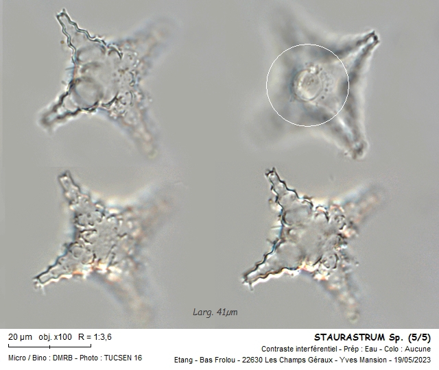 STAURASTRUM crenulatum #74649