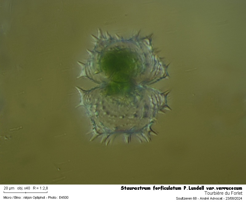 Staurastrum forficulatum P.Lundell var.verrucosum Grönblad #79936