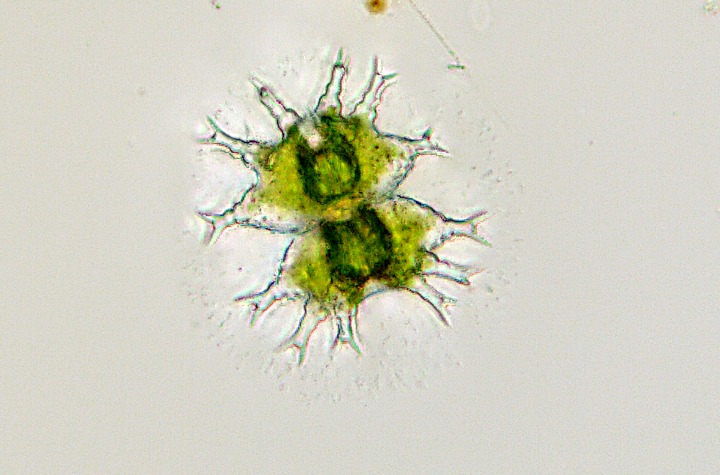 Staurastrum furcigerum #79692