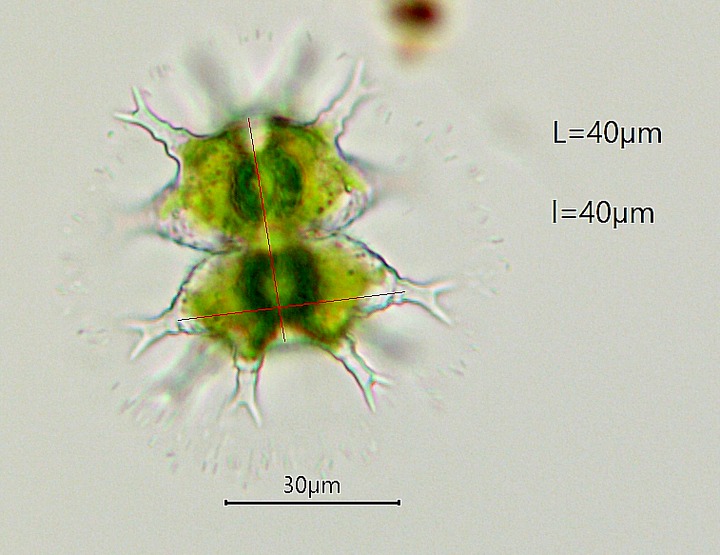 Staurastrum furcigerum #79691
