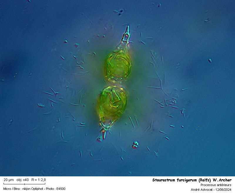 Staurastrum furcigerum (Ralfs) W. Archer #79098