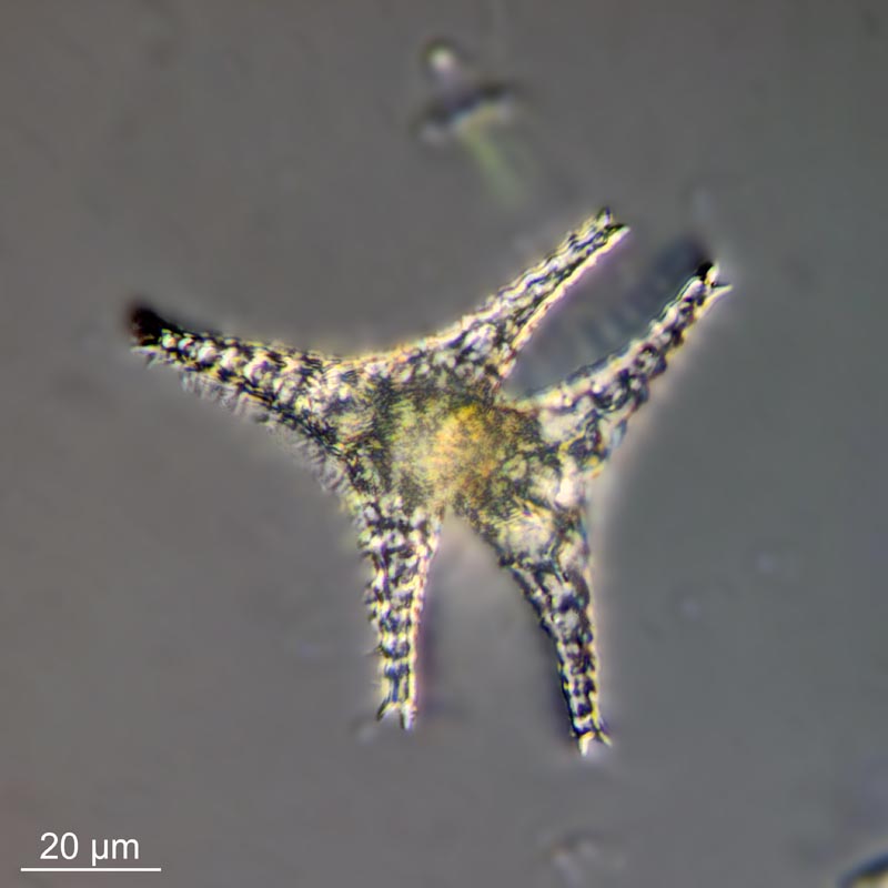 Staurastrum manfeldtii Delponte #51227