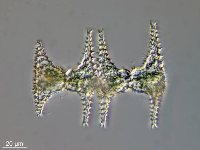 Staurastrum manfeldtii Delponte #51226