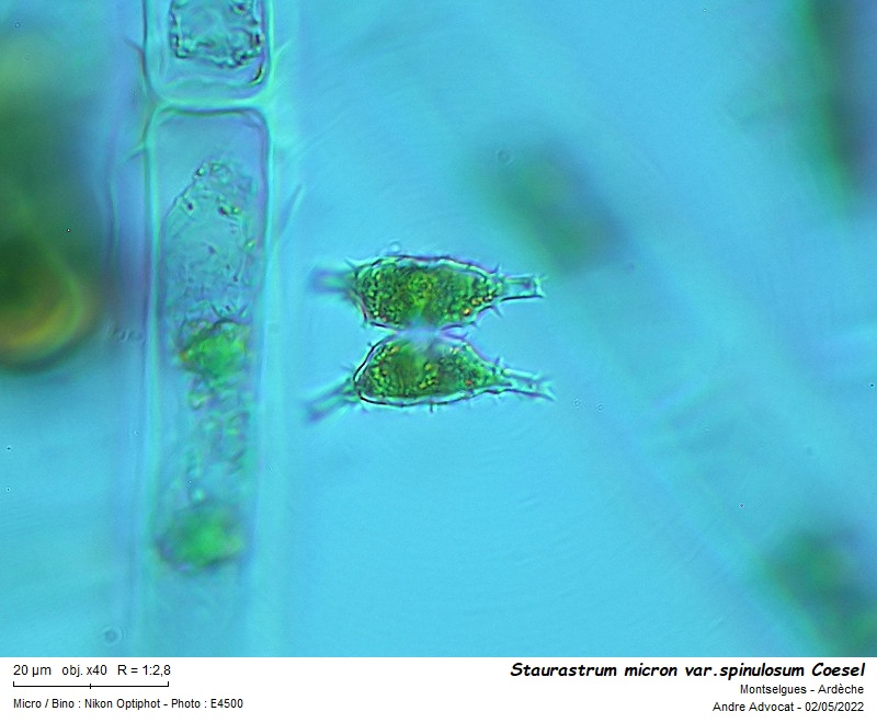 Staurastrum micron W. & G.S.West #70174