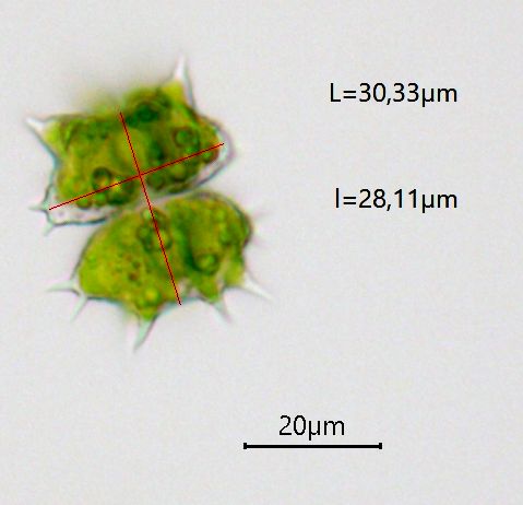 Staurastrum monticulosum #73560