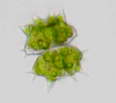 Staurastrum monticulosum #73561