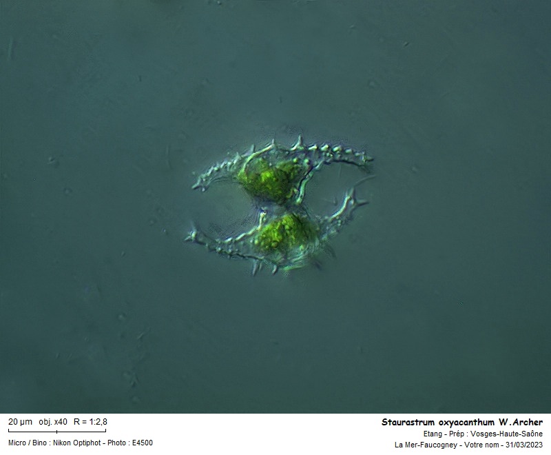 Staurastrum oxyacanthum W. Archer #74060