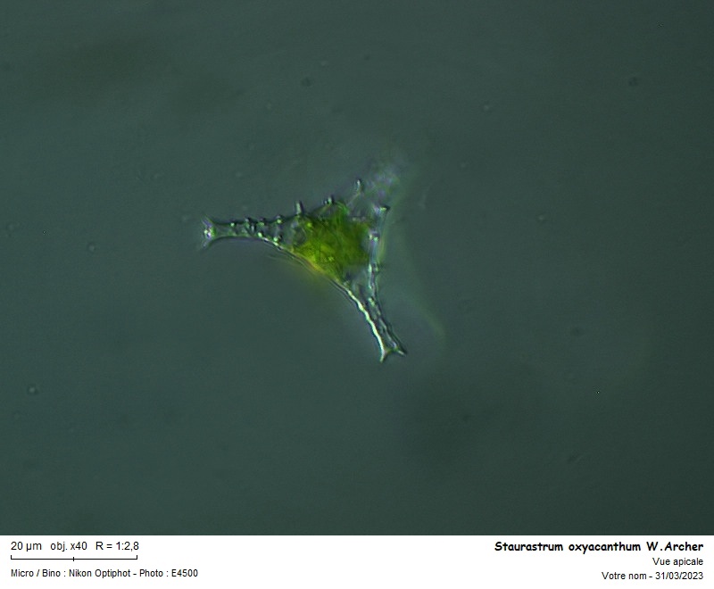 Staurastrum oxyacanthum W. Archer #74061