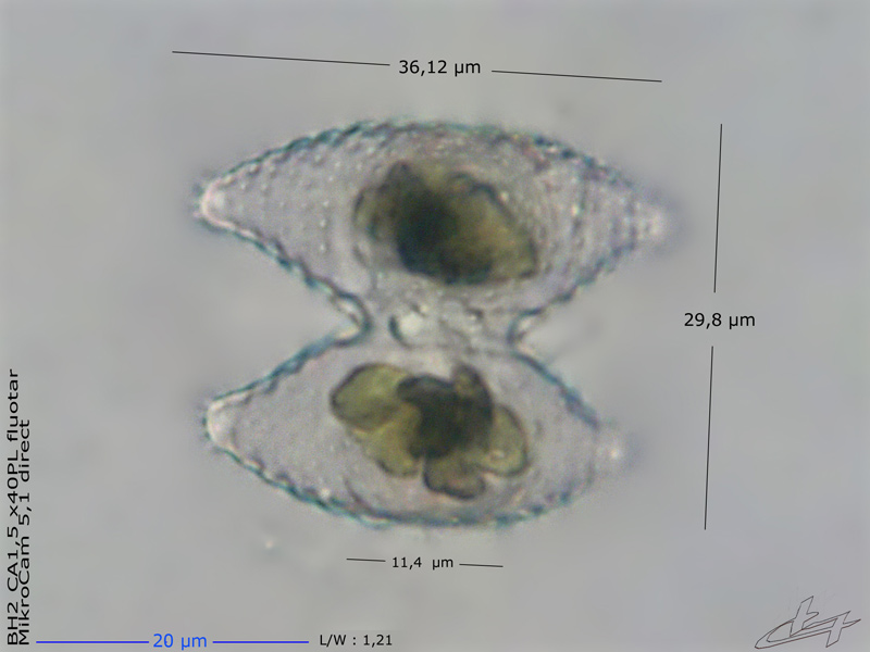 Staurastrum proboscideum (Ralfs) W. Archer #77735