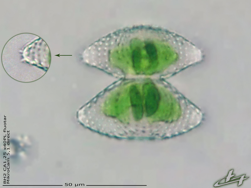 Staurastrum proboscideum (Ralfs) W. Archer #77736