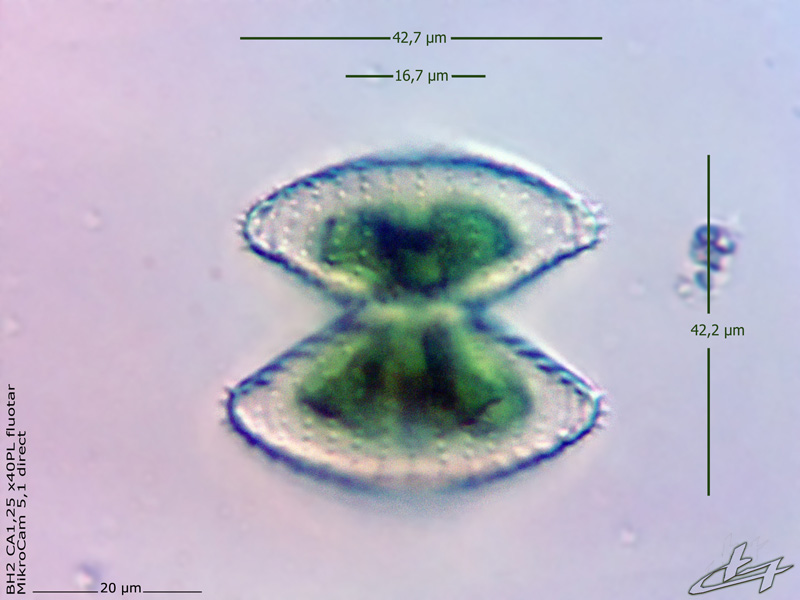 Staurastrum proboscideum (Ralfs) W. Archer #77740