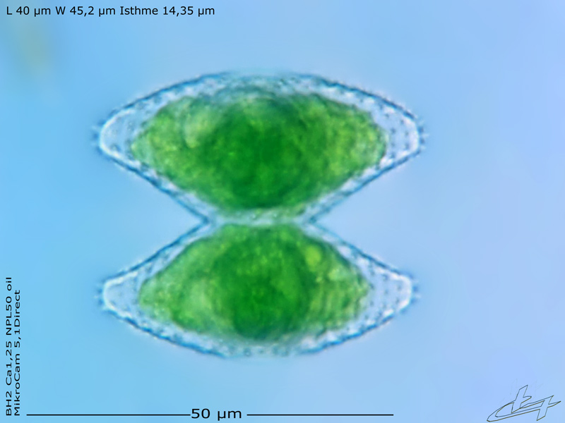 Staurastrum proboscideum (Ralfs) W. Archer #77739
