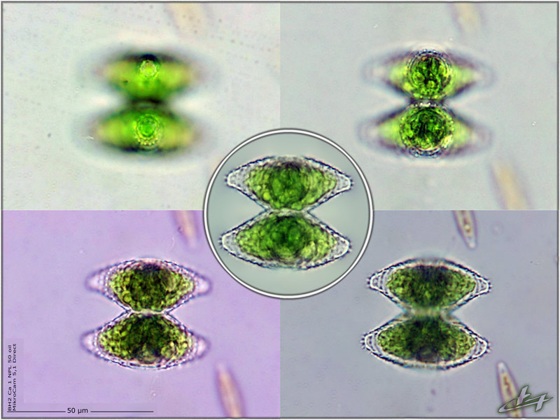 Staurastrum proboscideum (Ralfs) W. Archer #77738