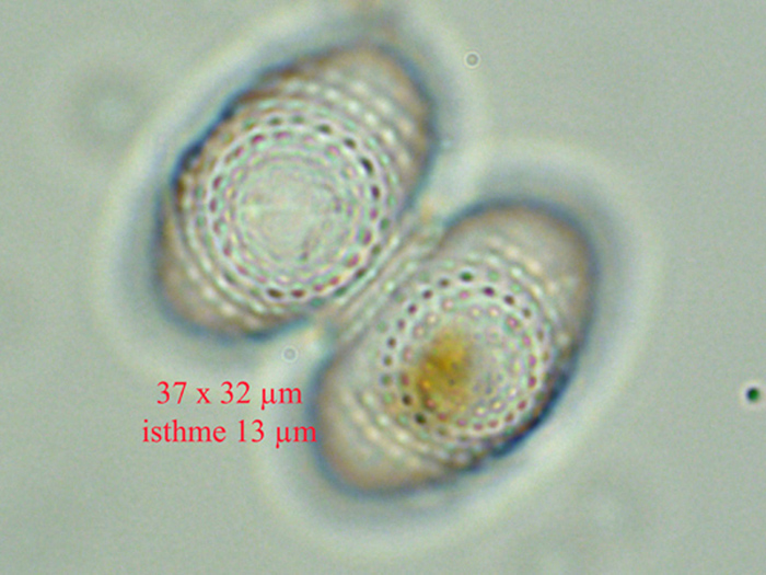 Staurastrum punctulatum #77234