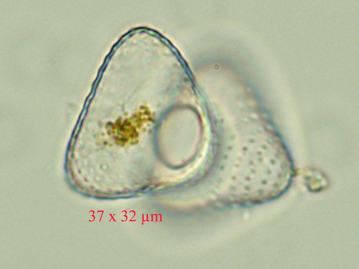 Staurastrum punctulatum #77233