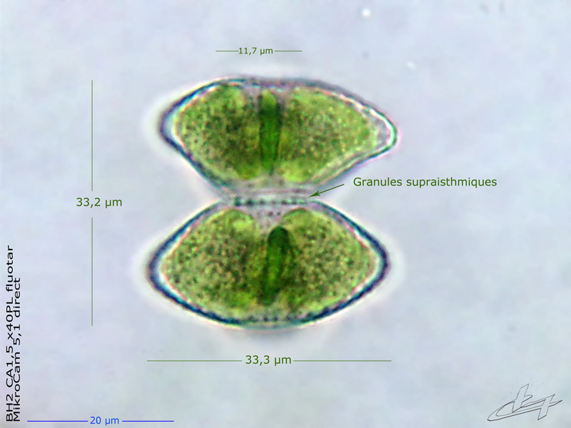Staurastrum punctulatum var. striatum. W. et G.S. West. #77408