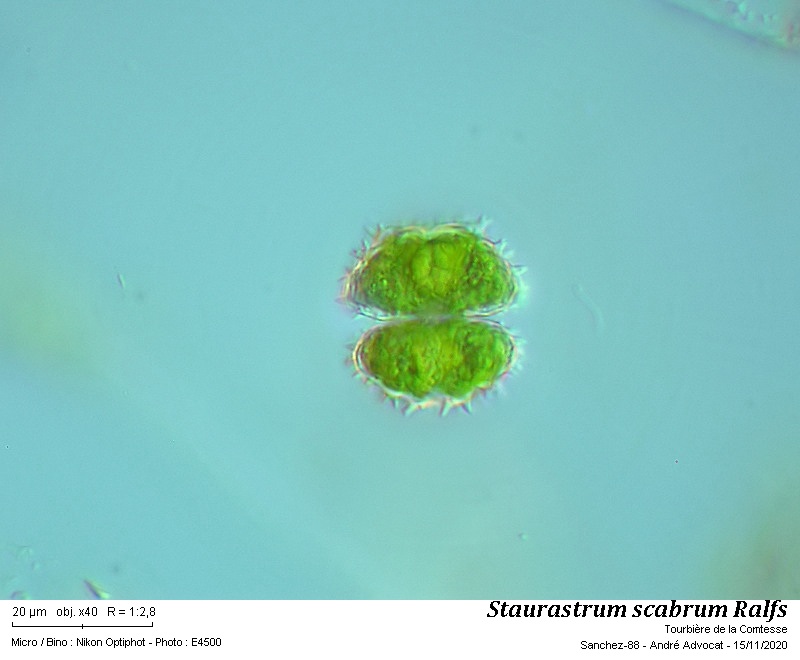 Staurastrum scabrum Ralfs #64833
