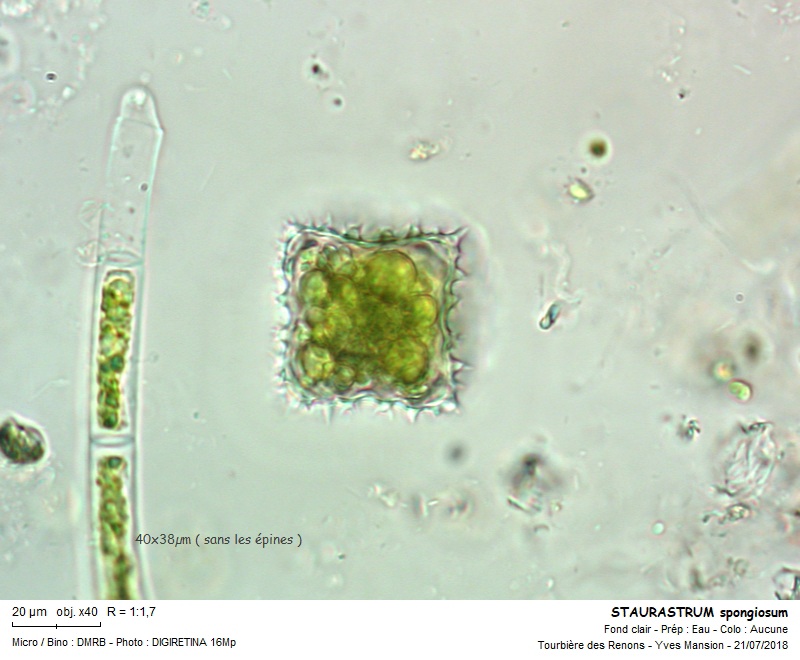 STAURASTRUM spongiosum #55643