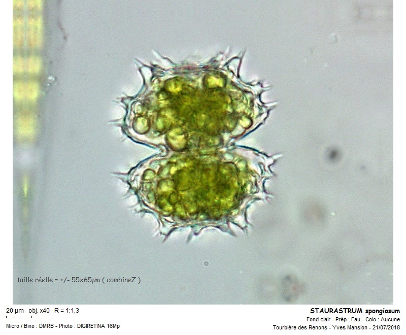 STAURASTRUM spongiosum #55642
