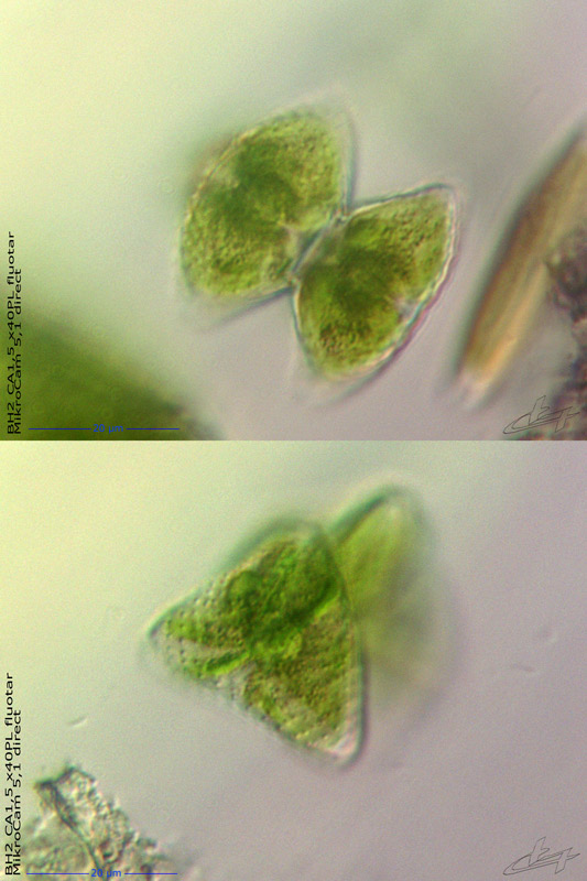 Staurastrum striatum  (W. et GS. West) Ruzicka #77692