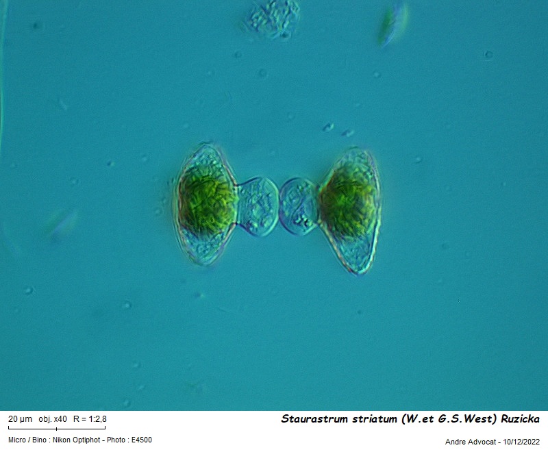 Staurastrum striatum (W.et G.S.West) Ruzicka #73026