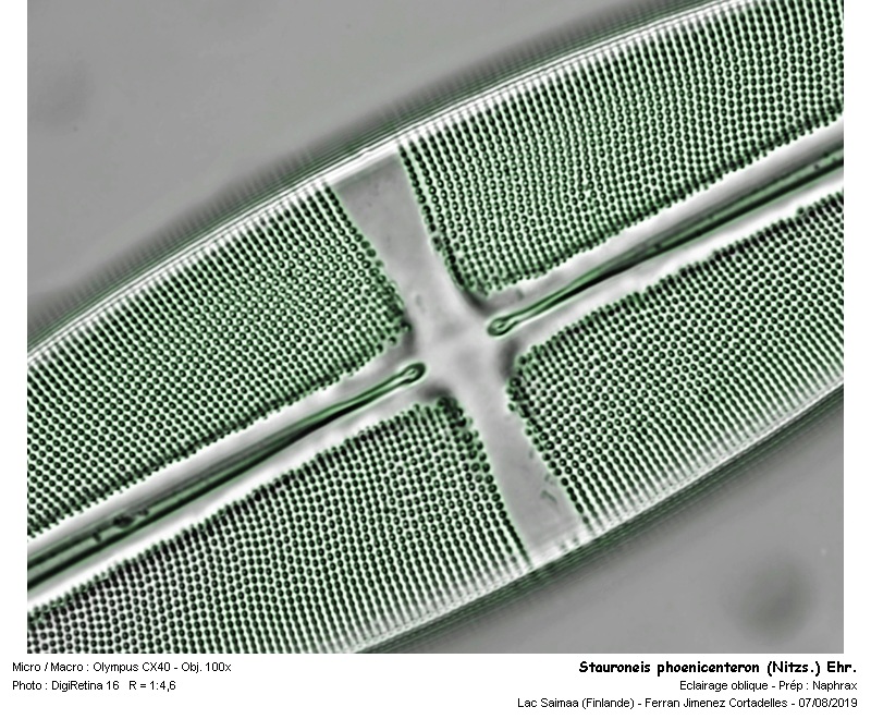 Stauroneis phoenicenteron (Nitzs.) Ehr. #63412