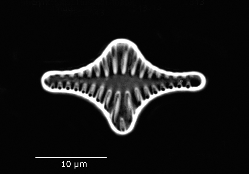 Staurosira pinnata #60184