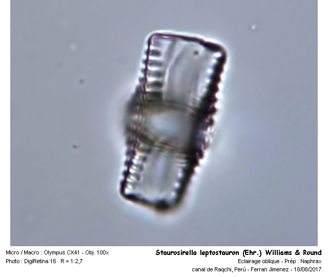 Staurosirella leptostauron (Ehr.) Williams & Round #55014