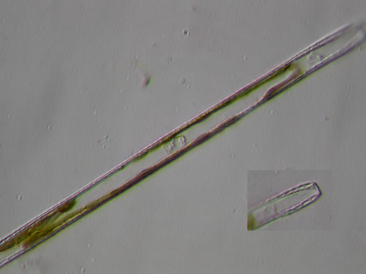 Stenopterobia curvula (W.Smith)Krammer #2728