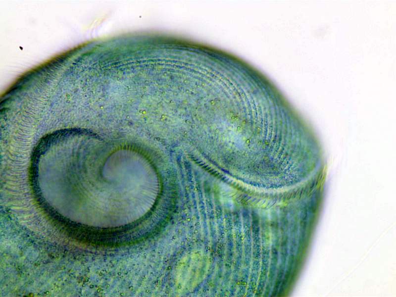 Stentor coeruleus #35338