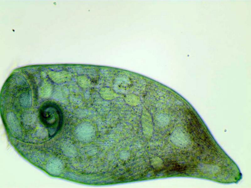Stentor coeruleus #35231