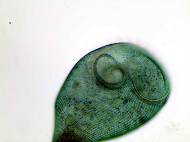 Stentor coeruleus #35339