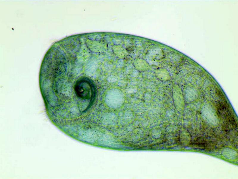 Stentor coeruleus #35228