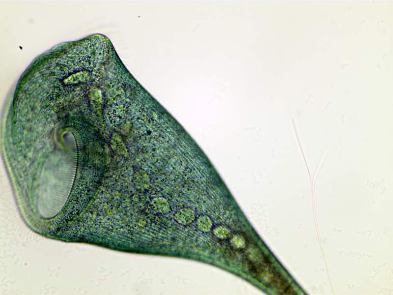Stentor coeruleus #35340