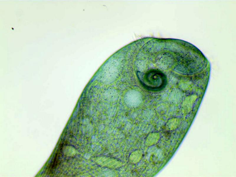 Stentor coeruleus #35229