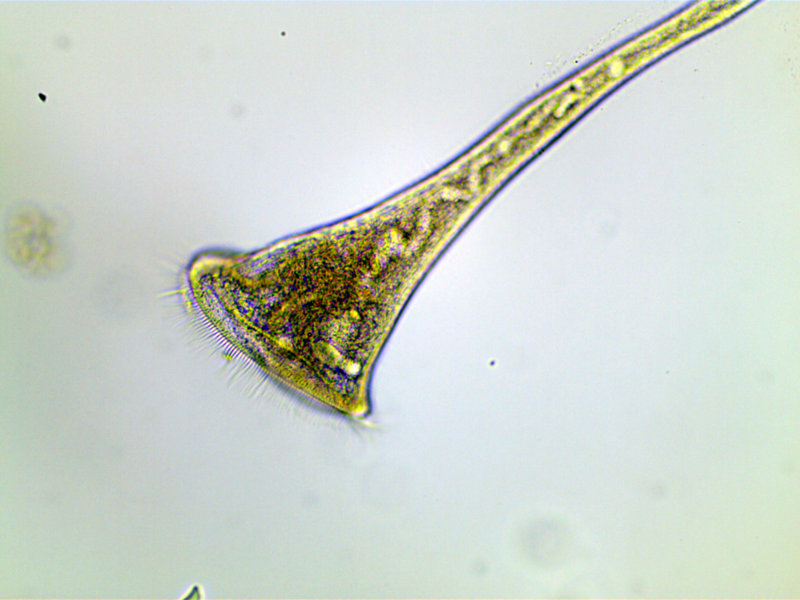 Stentor roeselii #35314
