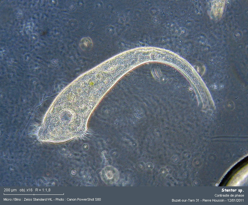 Stentor sp. #20231